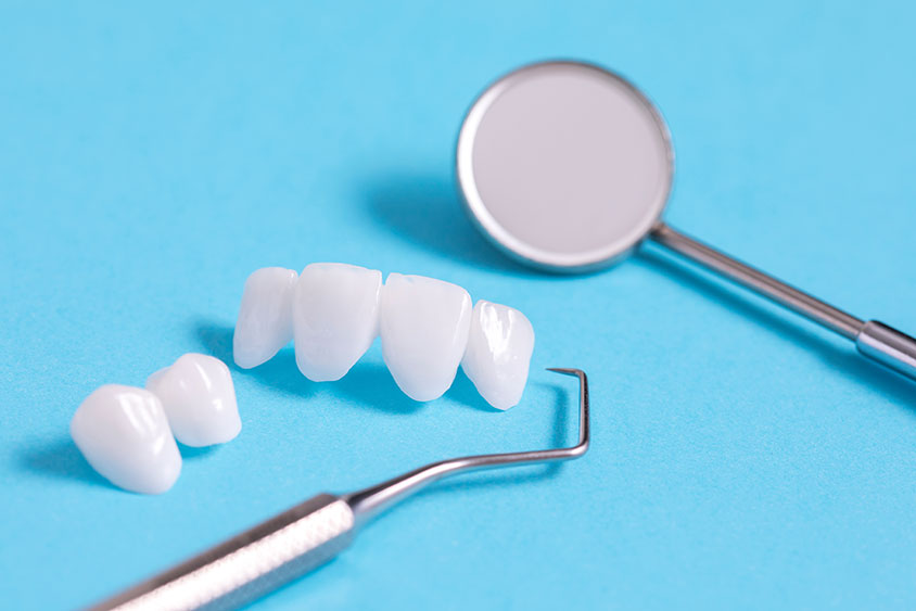 dental veneers on blue background